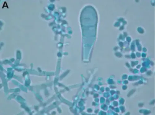 BREAKING: First case of TMVII confirmed in Washington, say health officials