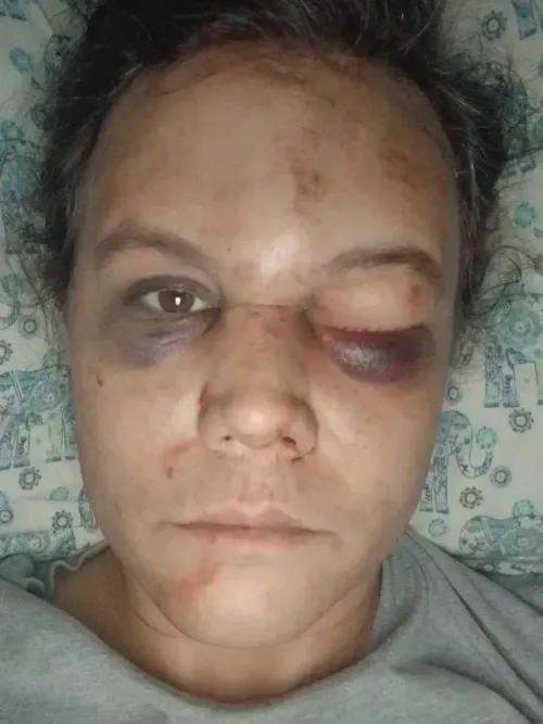 Justice for Nikki Armstrong: A Transgender woman’s story of assault, survival, and perseverance [Updated Sept. 24] 